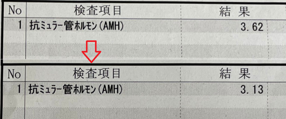 AMH