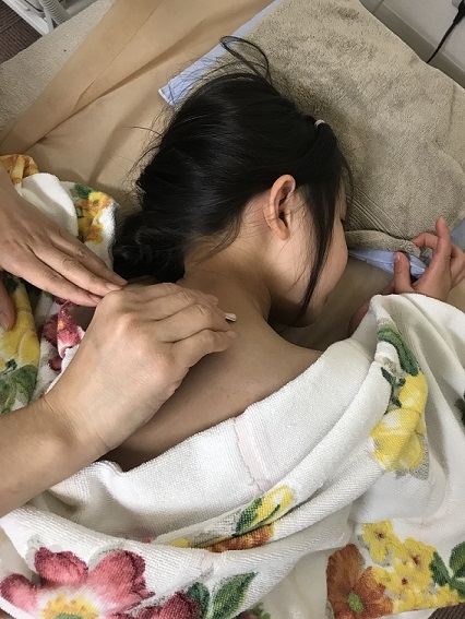 胃腸炎の５歳女児